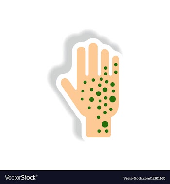 Paper sticker various symptoms of zika on vector image
