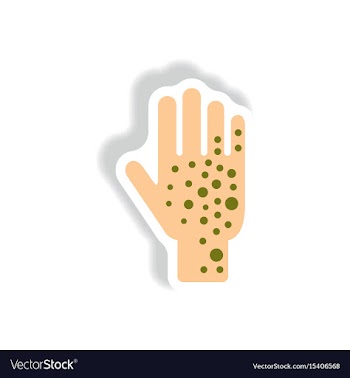 Paper sticker various symptoms of zika on vector image
