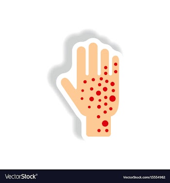 Paper sticker various symptoms of zika on vector image