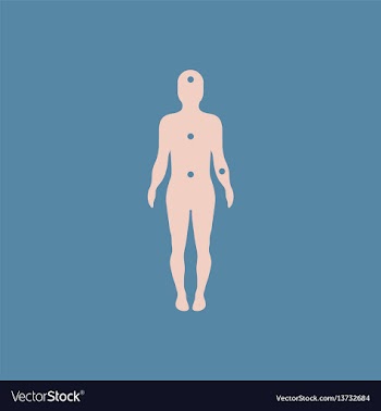 Patients point on the human body various symptoms vector image