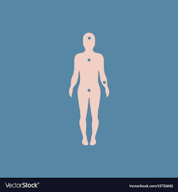 Patients point on the human body various symptoms vector image