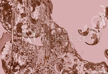 Pink textured background