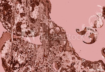 Pink textured background
