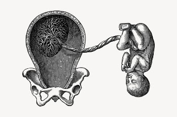 Placenta collage element, drawing illustration | Free Vector Illustration - rawpixel