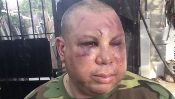 Police officers arrested, fired after allegedly beating up Latino ...