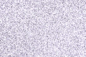 Purple glitter background | Free stock vector - 915691