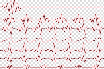 Red heart rate illustration, Red Heart rate Electrocardiography Monitoring, Red heartbeat line transparent background PNG clipart