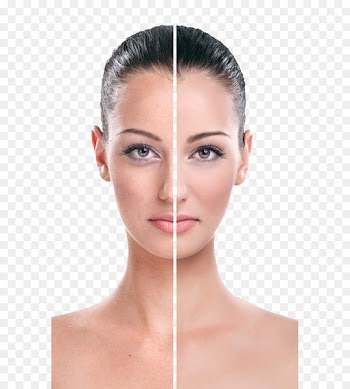 Rhytidectomy Eye Face Wrinkle Cream - White contrast beautiful models 