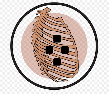 Rib cage Transcutaneous electrical nerve stimulation Osteoarthritis Back pain - electrode pennant 