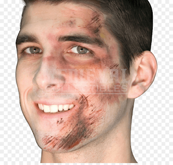 Scar png download - 850*850 - Free Transparent Scar png Download.