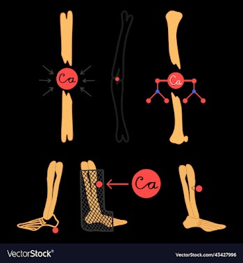 set with bone and calcium