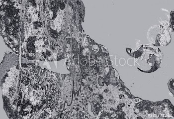Silver patterned background