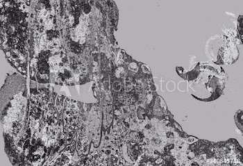 Silver patterned background