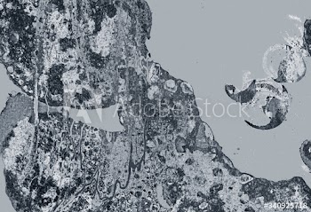 Silver patterned background