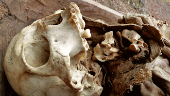 Skull