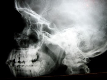 skullCN9695.jpg