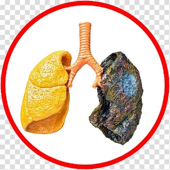 Smoking cessation Tobacco smoking Stop Smoking Now Health, health transparent background PNG clipart
