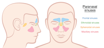 Sphenoid Sinusitis: One of The Most Dangerous Sinus Infection