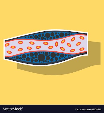 Sticker vienna human atherosclerosisthe structure vector image