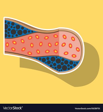 Sticker vienna human atherosclerosisthe structure vector image
