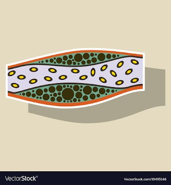 Sticker vienna human atherosclerosisthe structure vector image