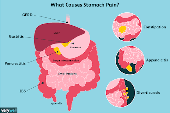 Stomach Pain: Causes, Treatment, and When to See a Doctor