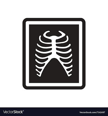Stylish black and white icon X-rays of ribs vector image