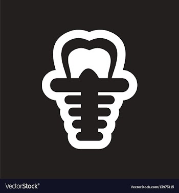 Stylish black and white icons tooth implant vector image