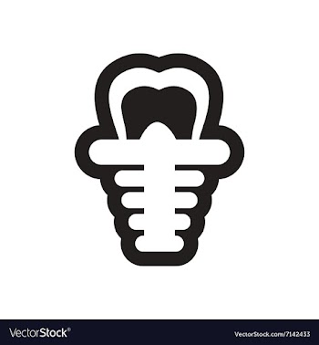 Stylish black and white icons tooth implant vector image