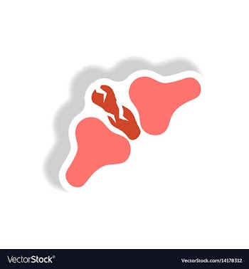 Stylish icon in paper sticker style bone fracture vector image