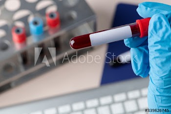 Surgeon holding a blood test