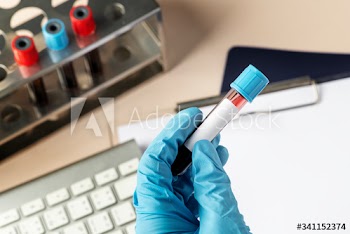 Surgeon holding a blood test