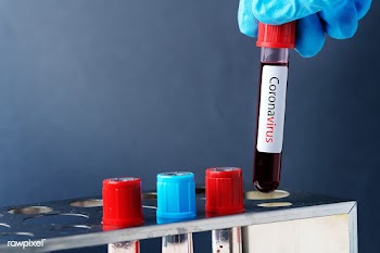 Surgeon holding a blood test tube mockup | Free  psd mockup - 2295549