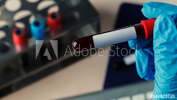 Surgeon holding a coronavirus blood test tube