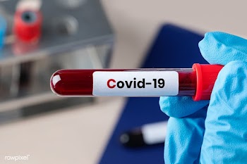Surgeon holding a coronavirus blood test tube  | Free  photo - 2303458