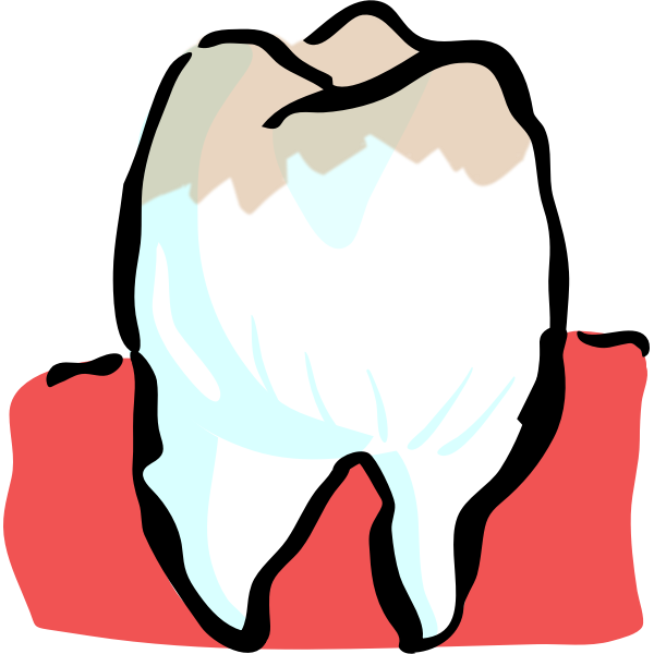 SVG Architetto -- Dente