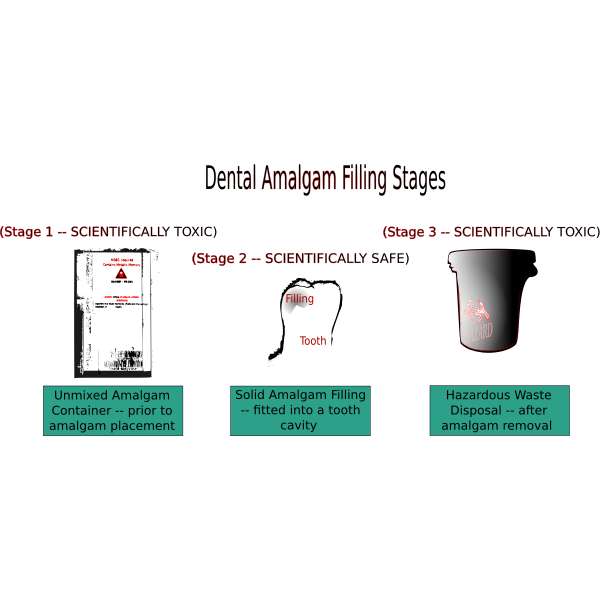 SVG Dental Amalgam Filling Stages