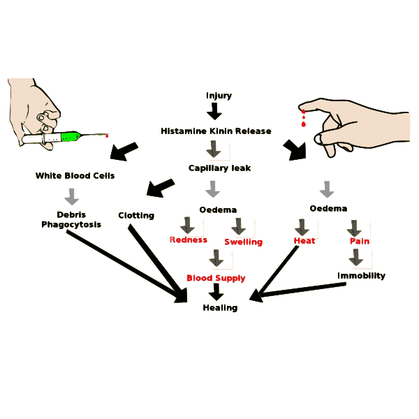 SVG Inflammation scheme vector image
