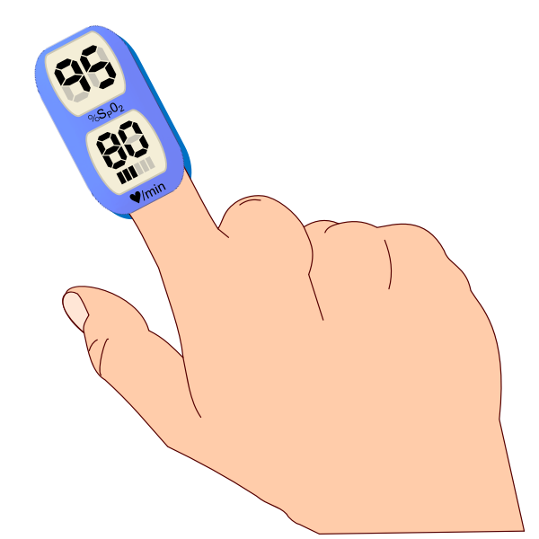 SVG Pulse Oximeter 2