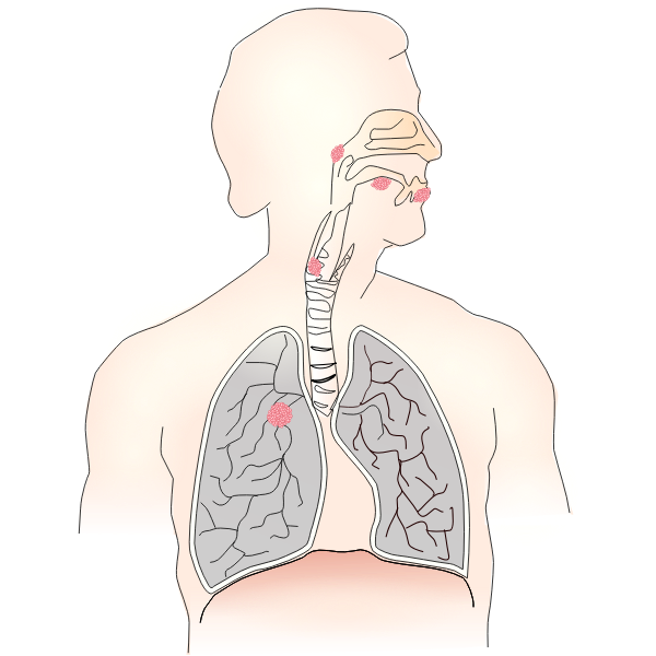 SVG Symbol for lung cancer vector image