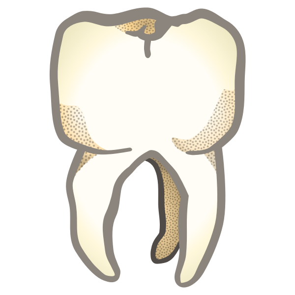 SVG tooth - coloured