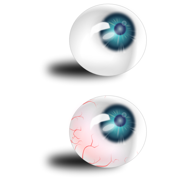 SVG Two eyeballs