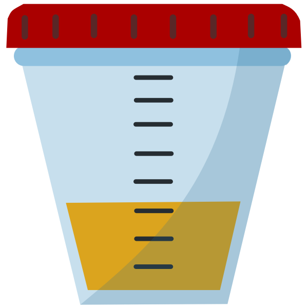 SVG Urine Sample