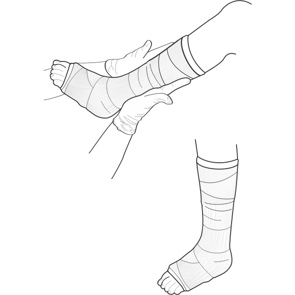 SVG Vector illustration of leg cast examination