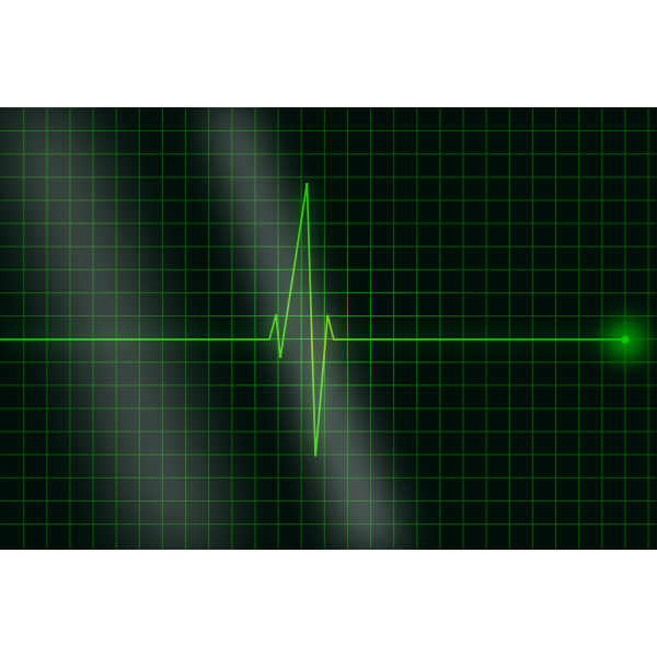 SVG Vector image of electrocardiogram