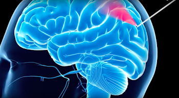 This tiny camera on a needle could enable safer brain surgeries ...