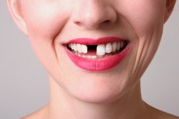 Tooth Gap PNG Transparent Tooth Gap.PNG Images. | PlusPNG