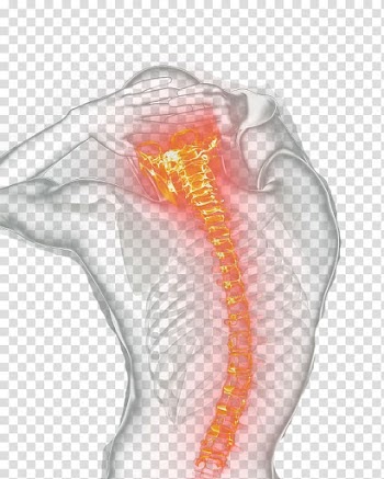 Transparency and translucency Managed care Health Care Light Hospital, skeleton transparent background PNG clipart