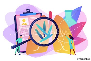 Tuberculosis concept vector illustration
