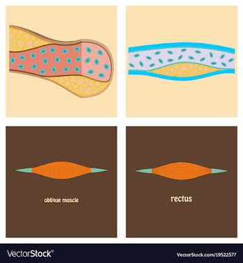 Types of muscle tissue of human body diagram vector image